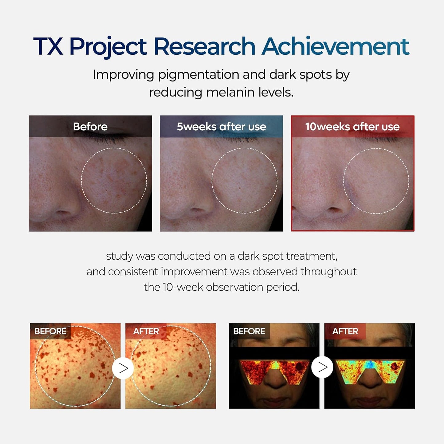 Dr. Melaxin TX-Cream (Tranexamic Acid + Niacinamide 70,000 ppm) 50 ML