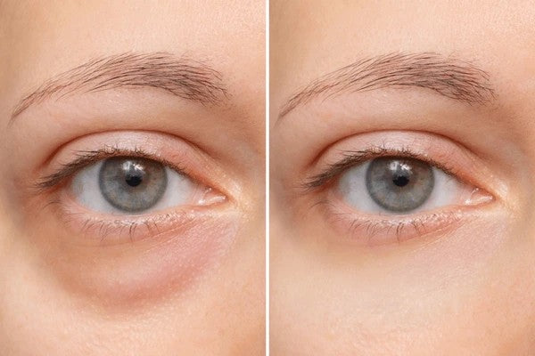 Dr. Melaxin Eyephalt Eyebag Cream – Korean Under Eye Lifting & Anti-Aging Treatment(10 ML)